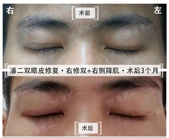 密封固化剂地坪 第71页